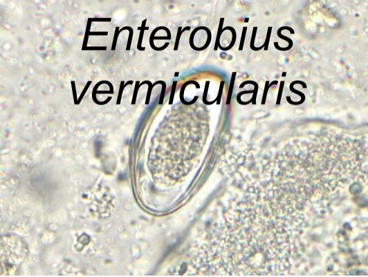 Enterobius vermicularis a bisayában - receptadatbazis.hu