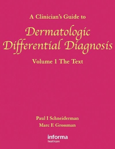 diagnosis banding psoriasis vulgaris pdf