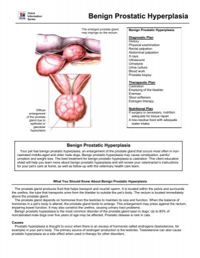 Prostate cancer benign hypertrophy. Symptomatology