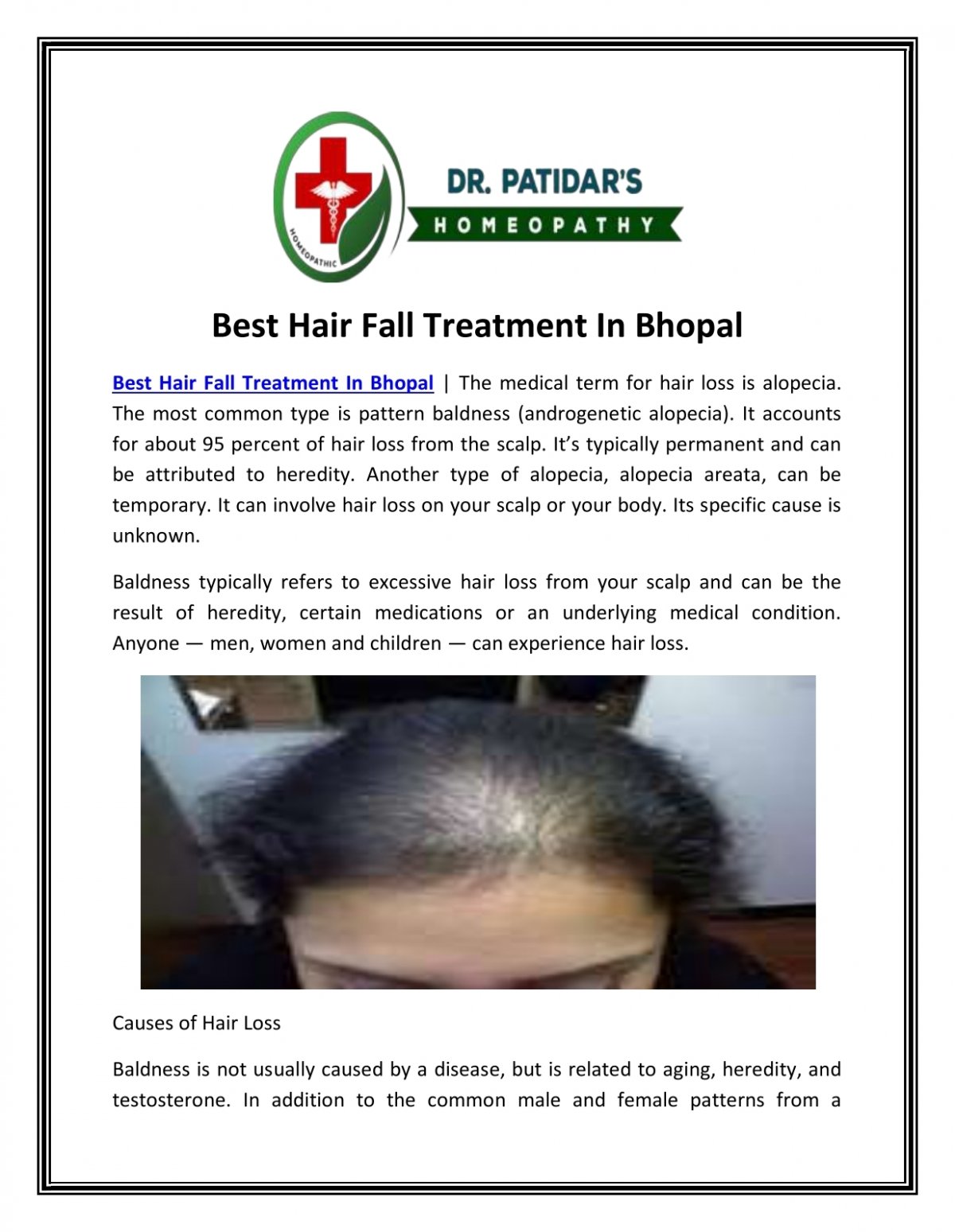 Hair Fall Treatment Service in Bhopal हयर फल टरटमट सरवस भपल